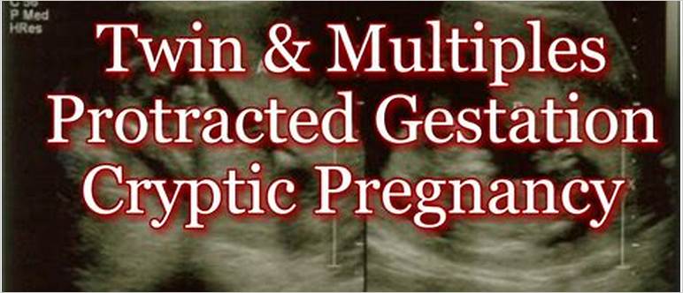 Cryptic pregnancy with twins